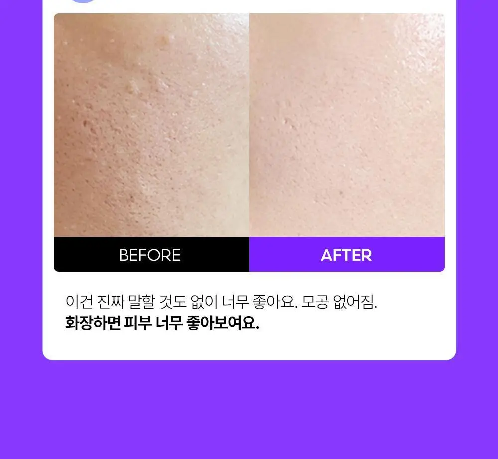 [올영단독/1+1+1] 프랭클리 모공축소 클로저 세럼 30ml 3입 기획 대용량앰플 상세페이지 27